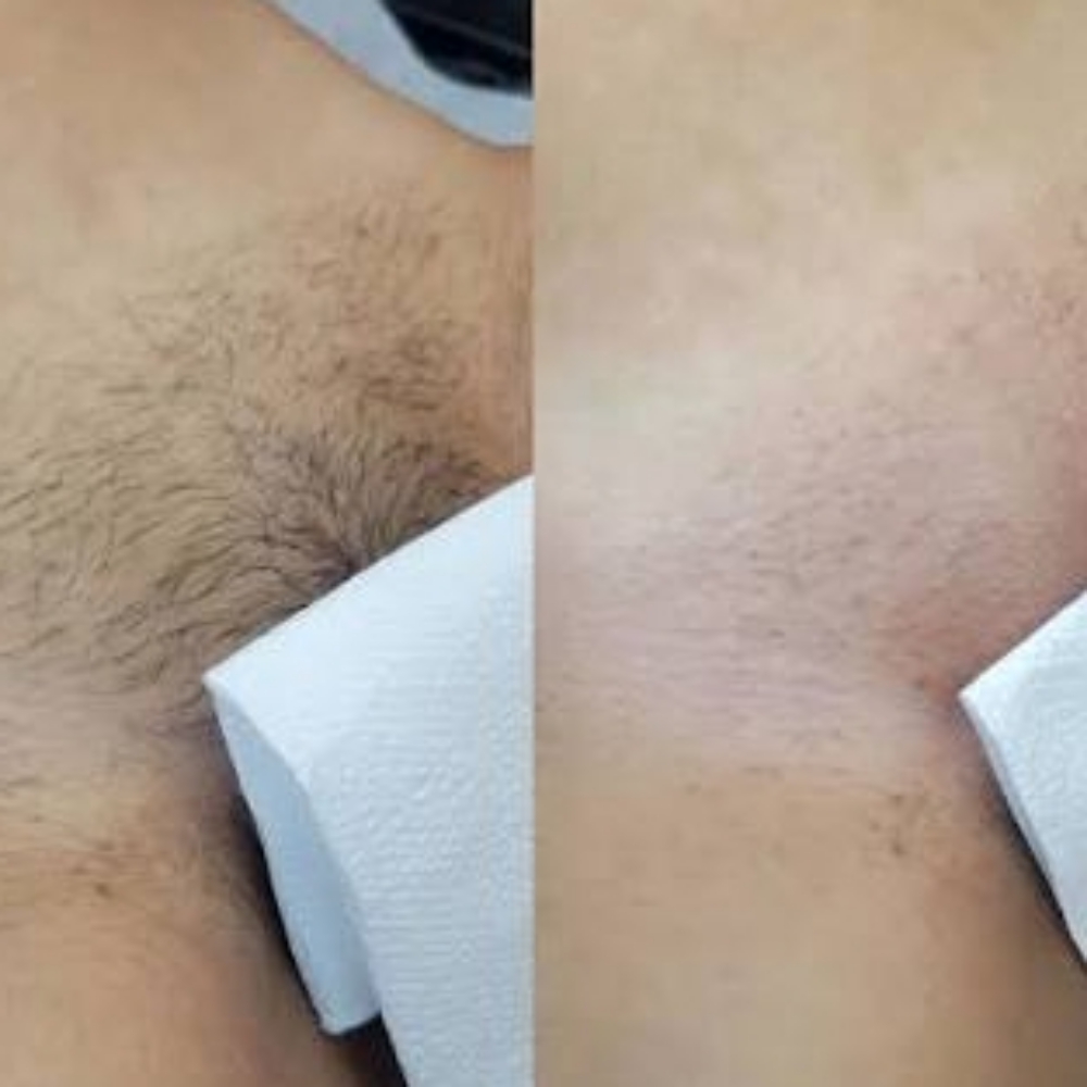 Brazilian + Underarm Wax at Winks Wonderland in BARSTOW, CA