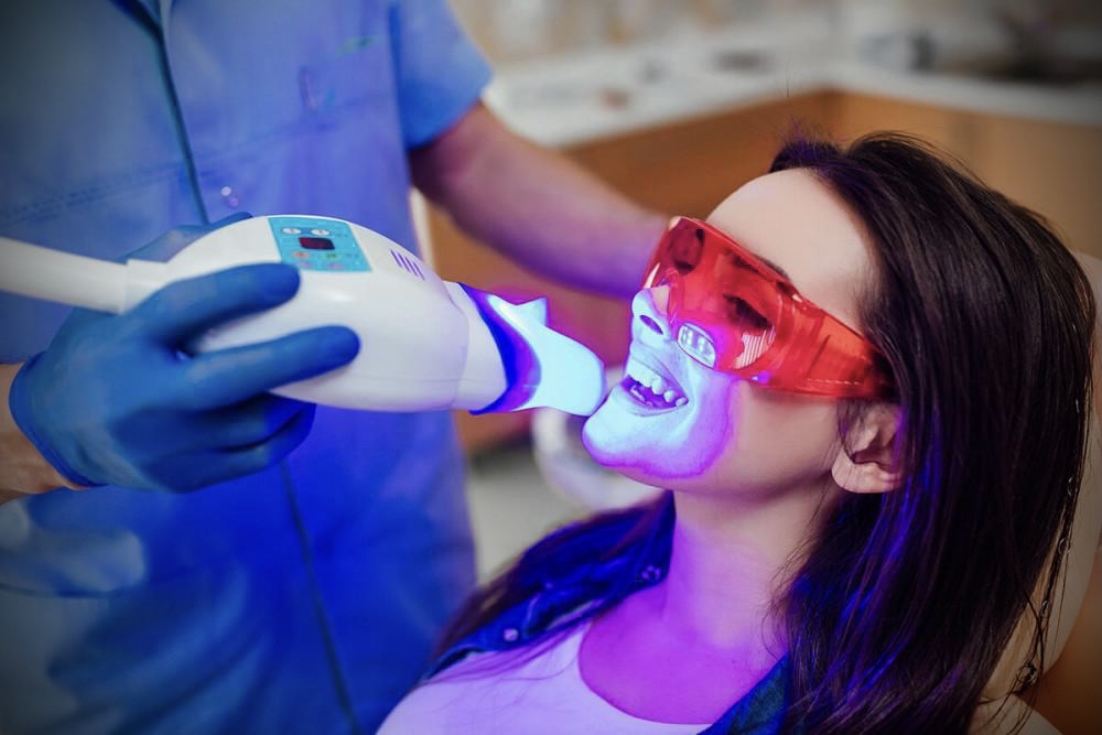 Teeth Whitening
