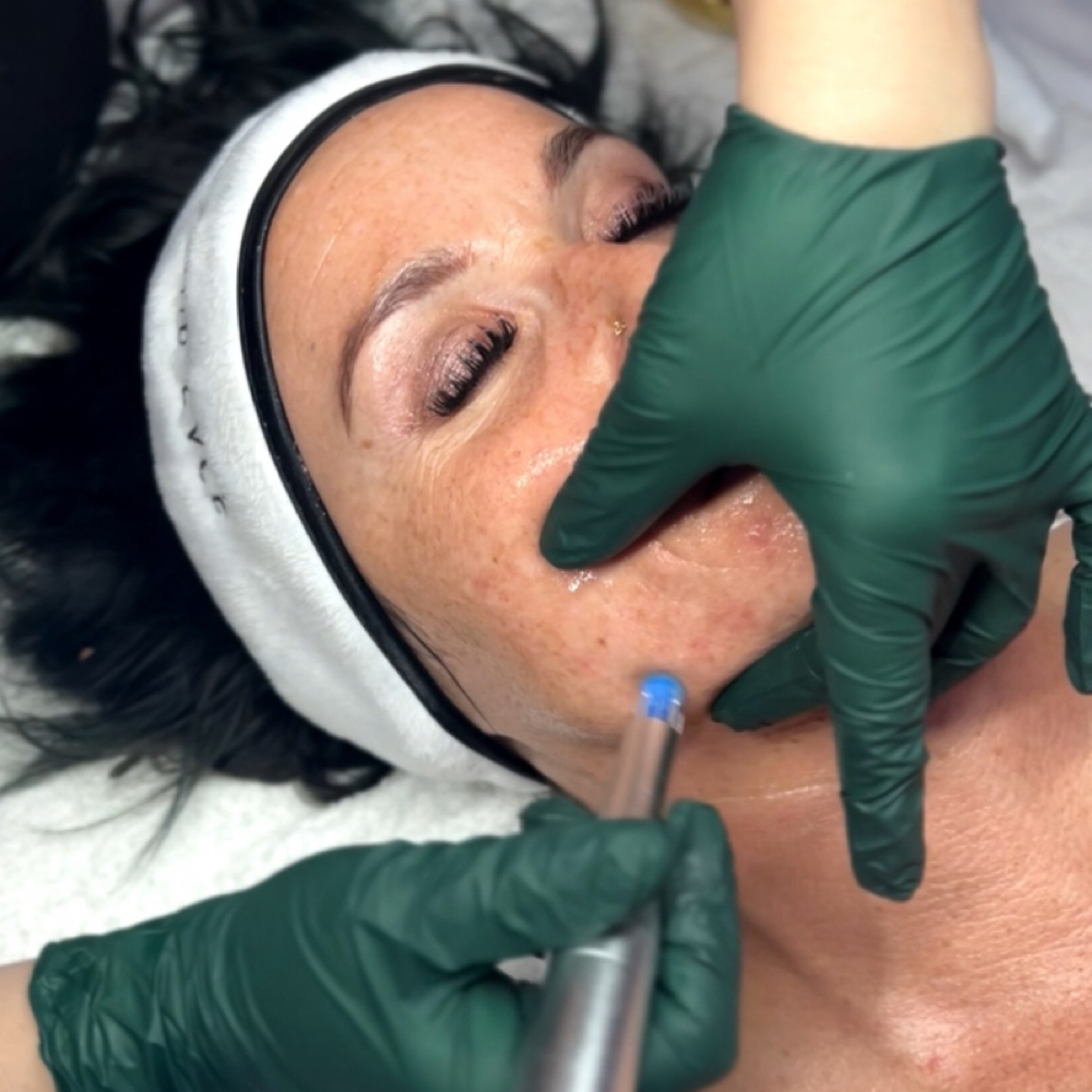 Nano-Infusion Facial at Nova Skin Studio in Getzville, NY