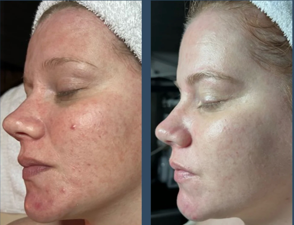 Week 5-7 Check In Appointment