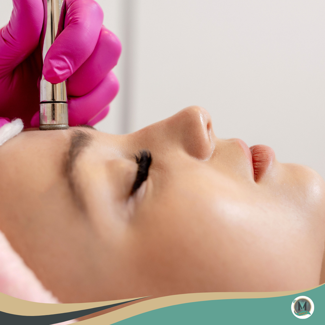 Microdermabrasion Facial