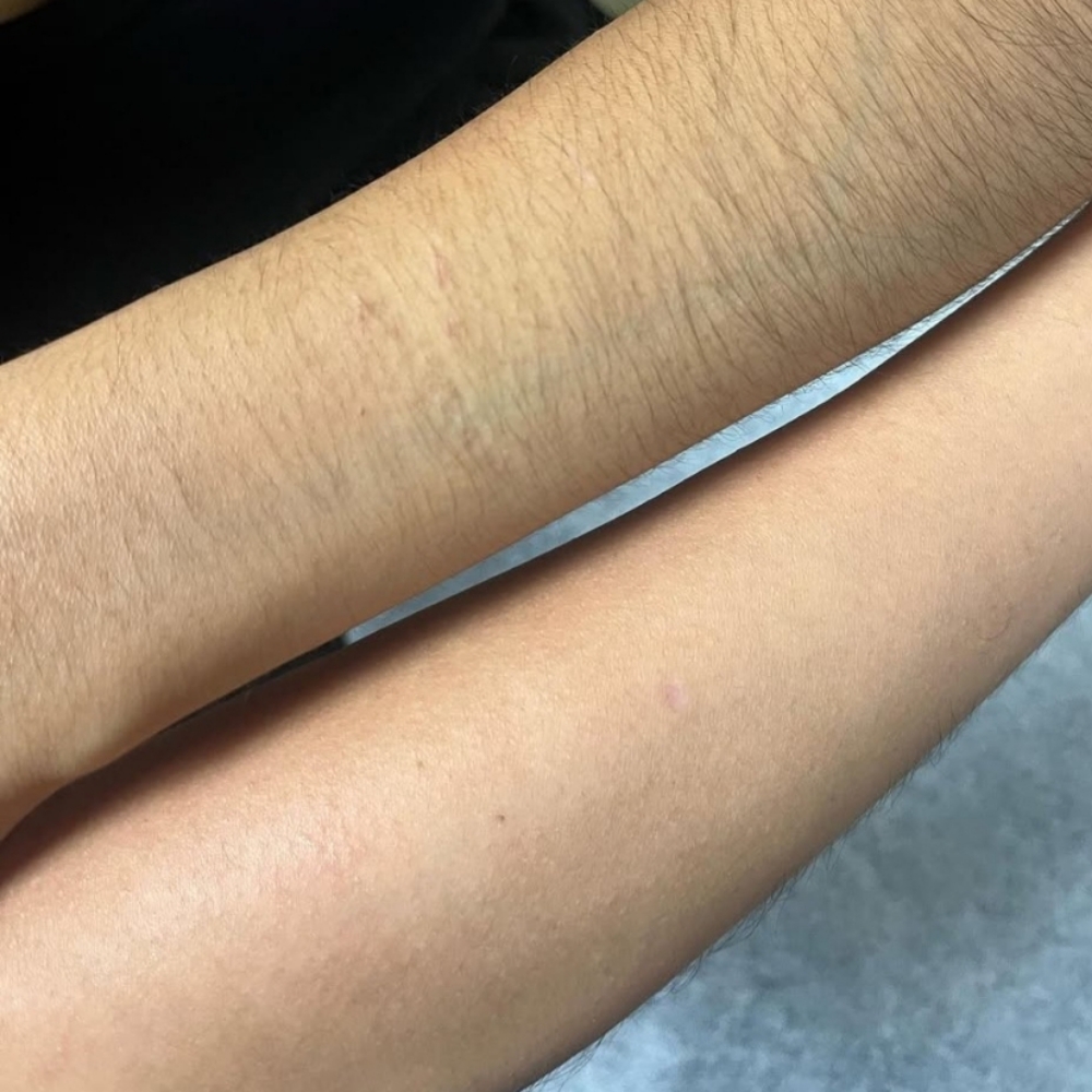 Half Arm Wax at the skin and wax spot in Pittsburgh, PA