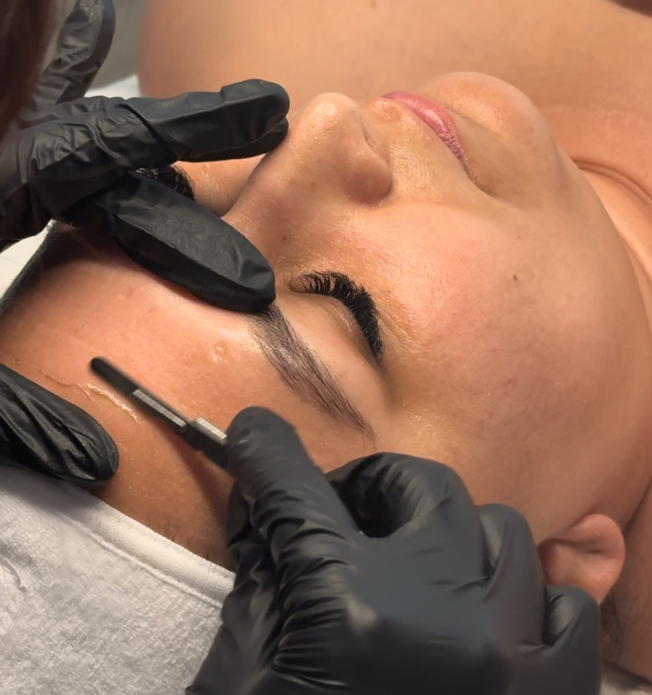 Dermaplane facial