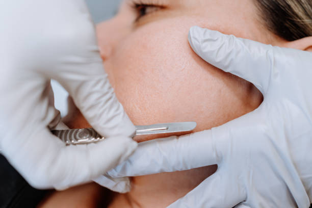 Dermaplane
