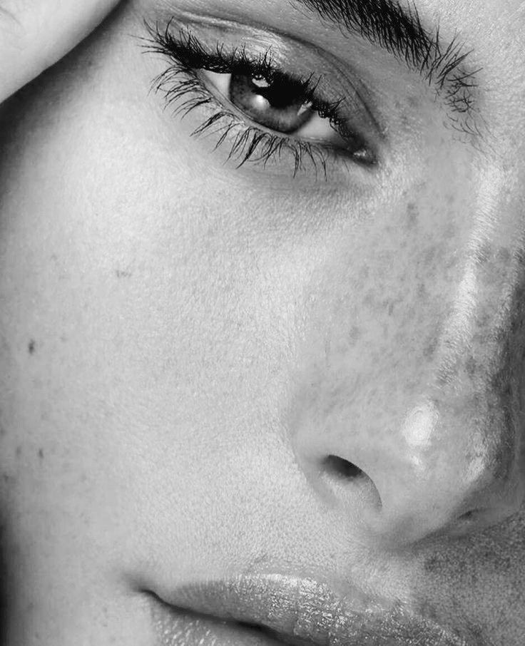 Pigmentation Removal