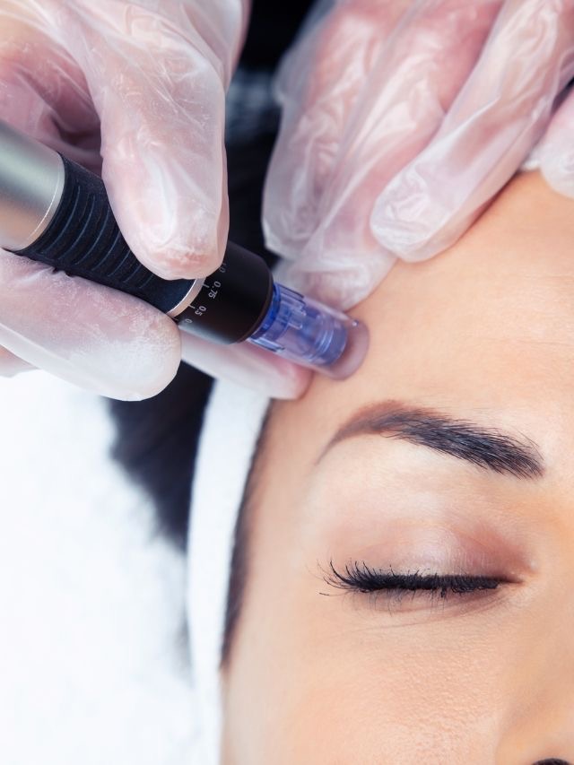 Microneedling Package Series Of 3