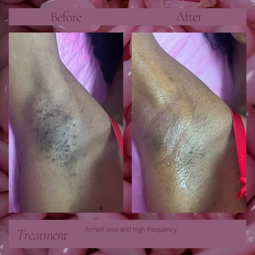Underarm Waxing