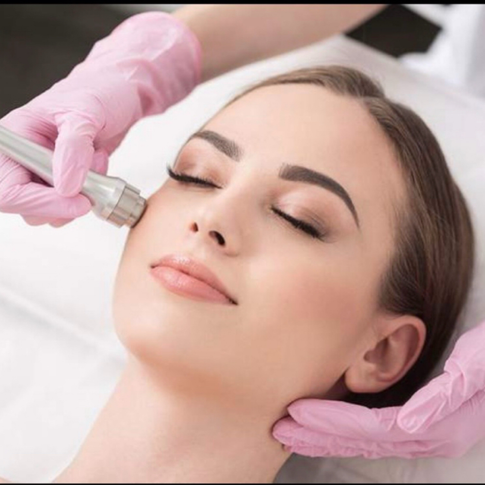 Basic Microdermabrasion treatment