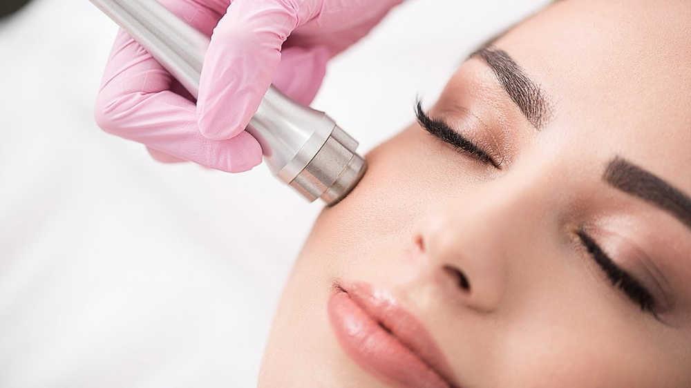 MICRODERMABRASION TREATMENT