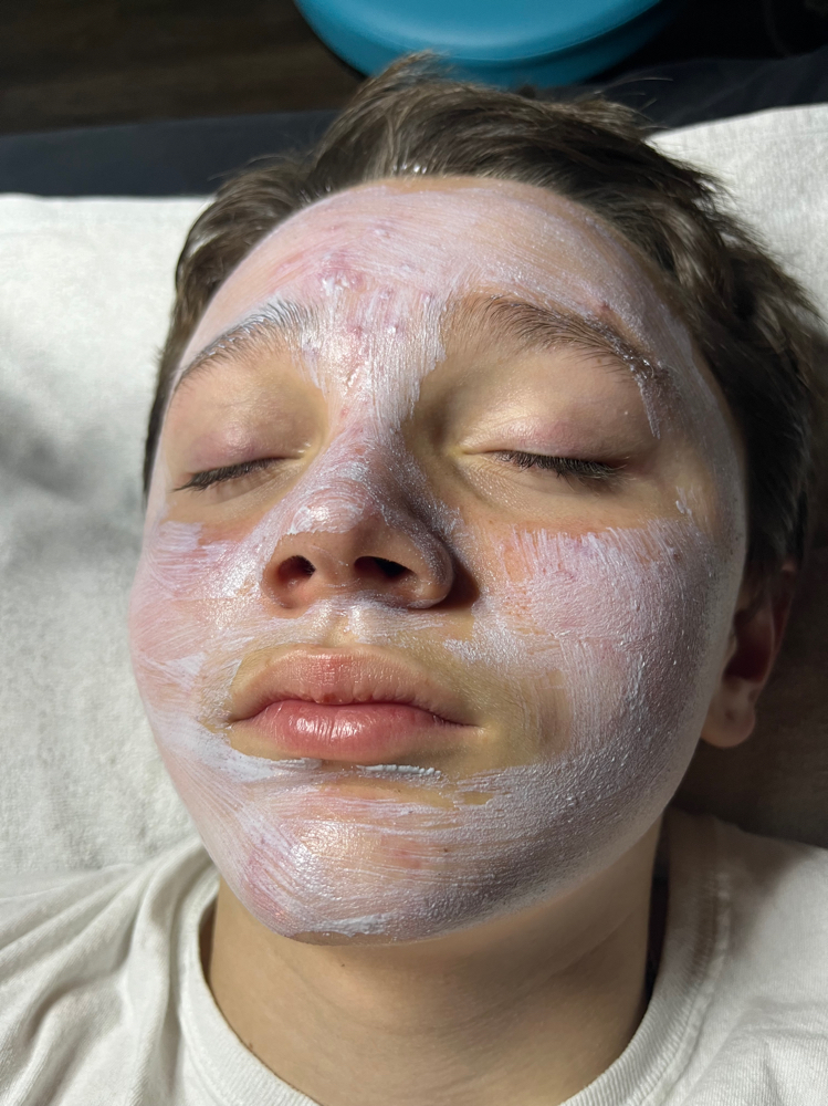 Teen Facial