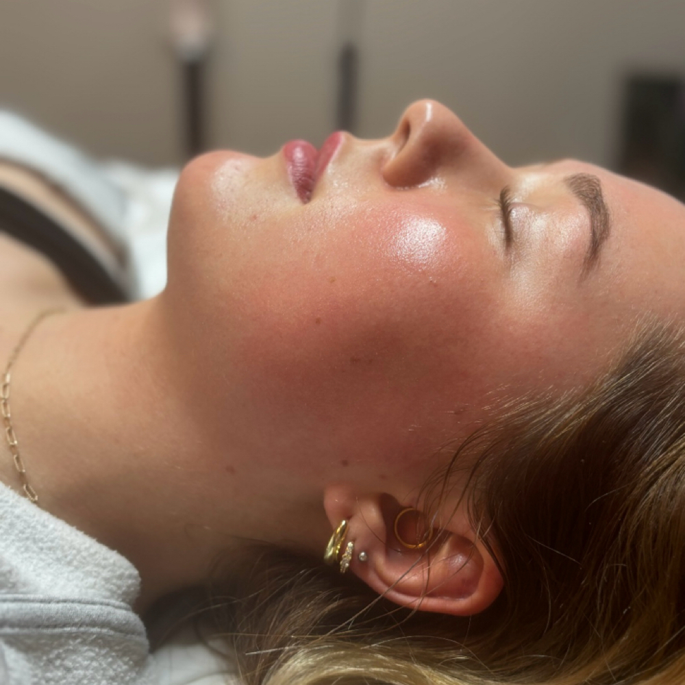 Glass Glow Dermaplane Facial at Radiant Glo Aesthetics in Ottawa, KS