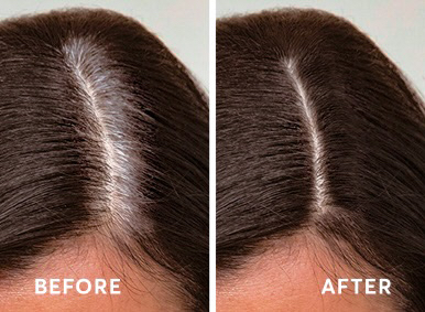 Color Retouch