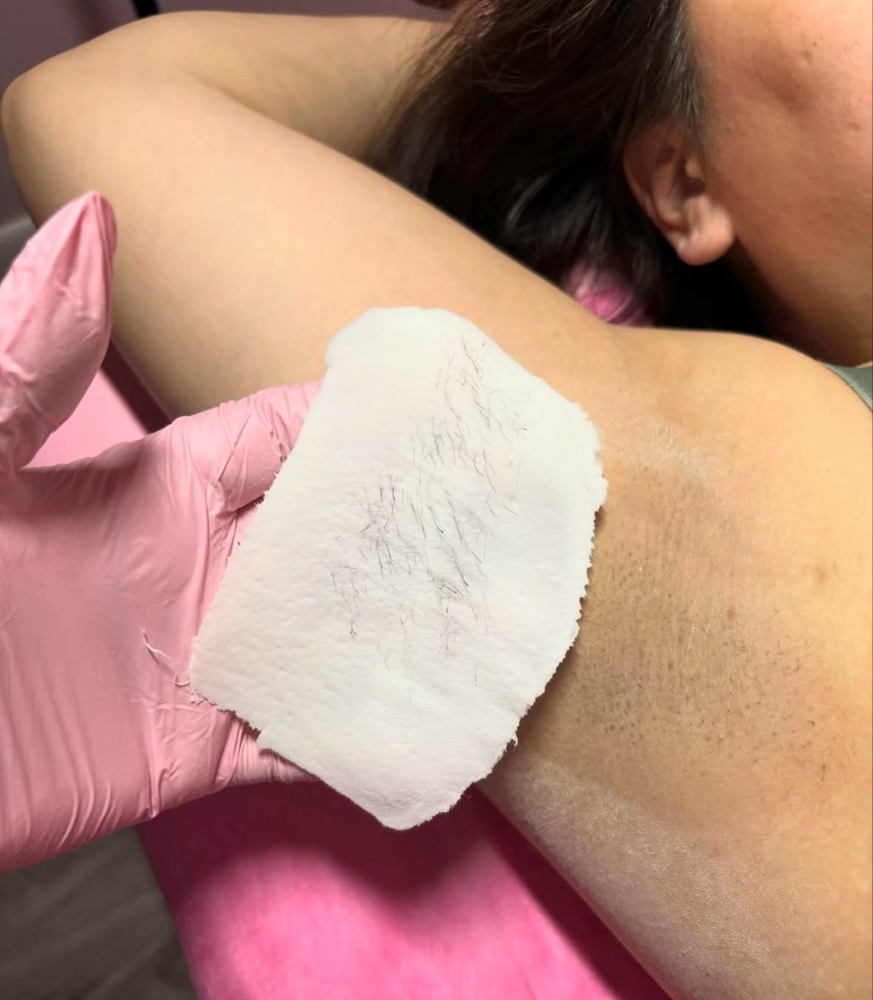 Underarm