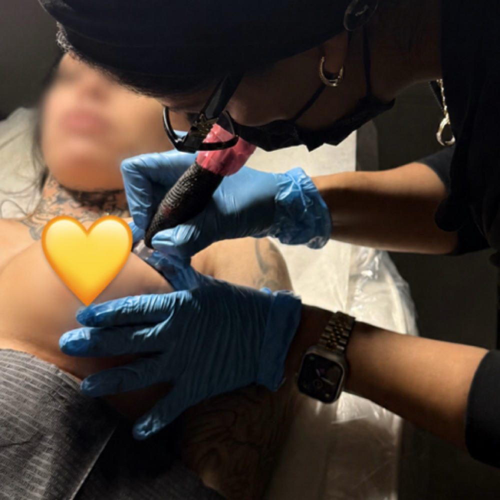 Areola Restoration at Skin Luminescence Co in Ft. Myers, FL