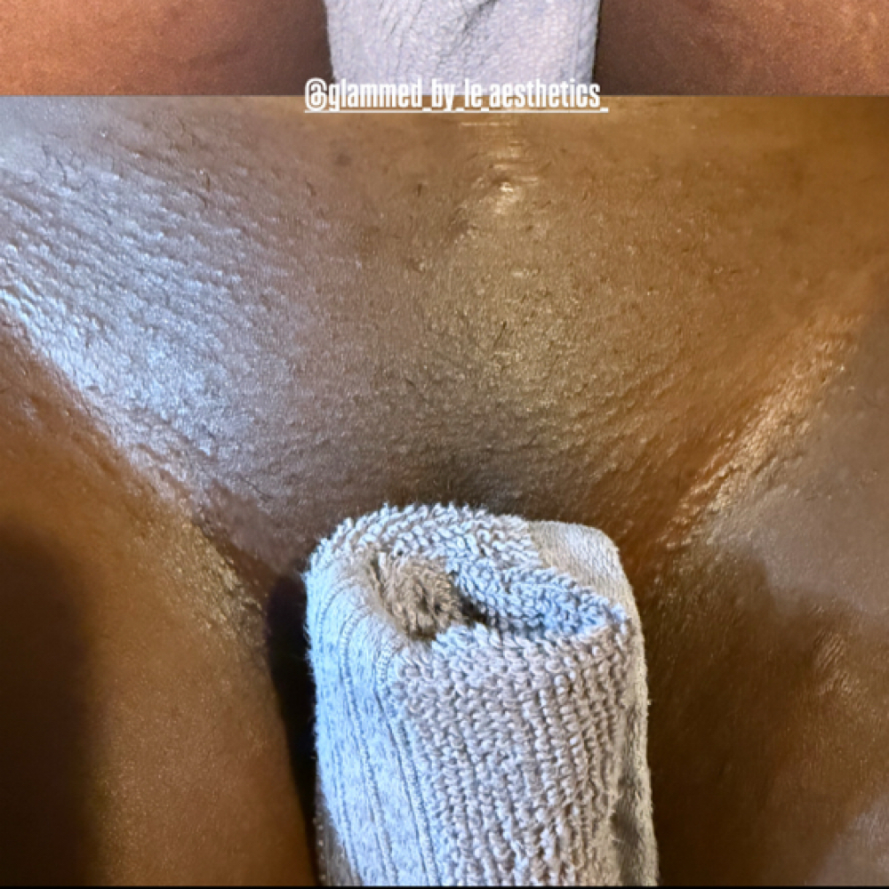 Brazilian + Vagacial at Glammed By Le Aesthetics in Ullin, IL