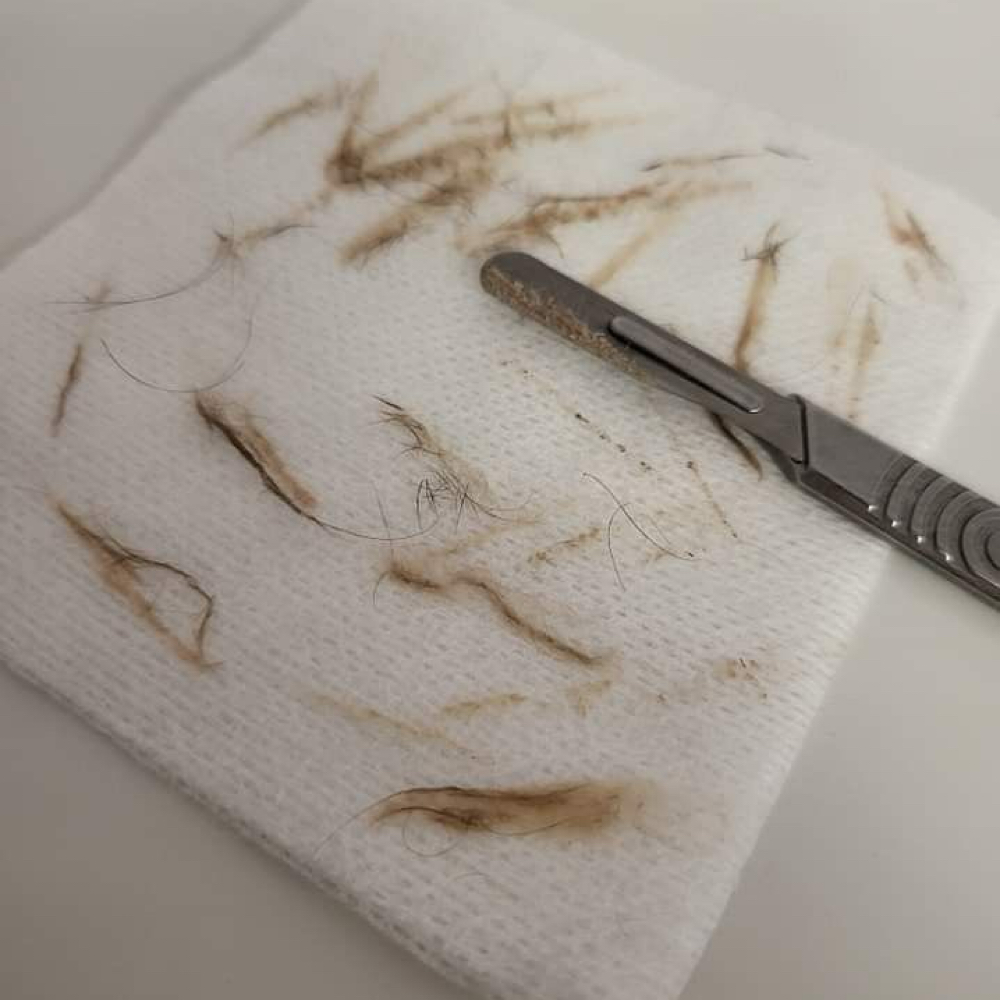 Dermaplaning at Psalms Aesthetics in Louisburg, KS