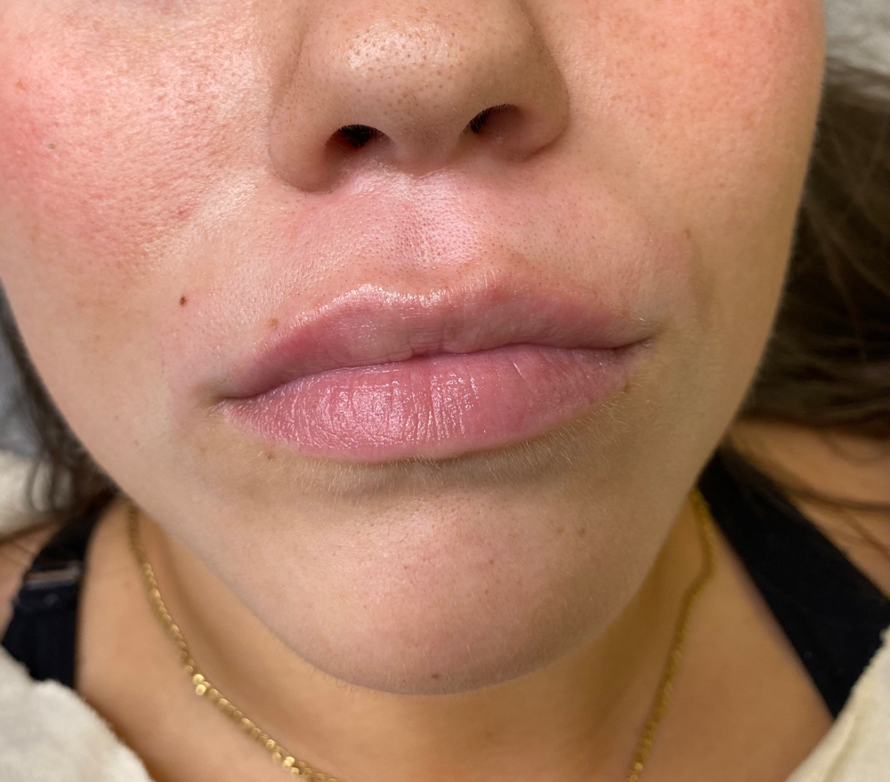 Upper Lip Wax