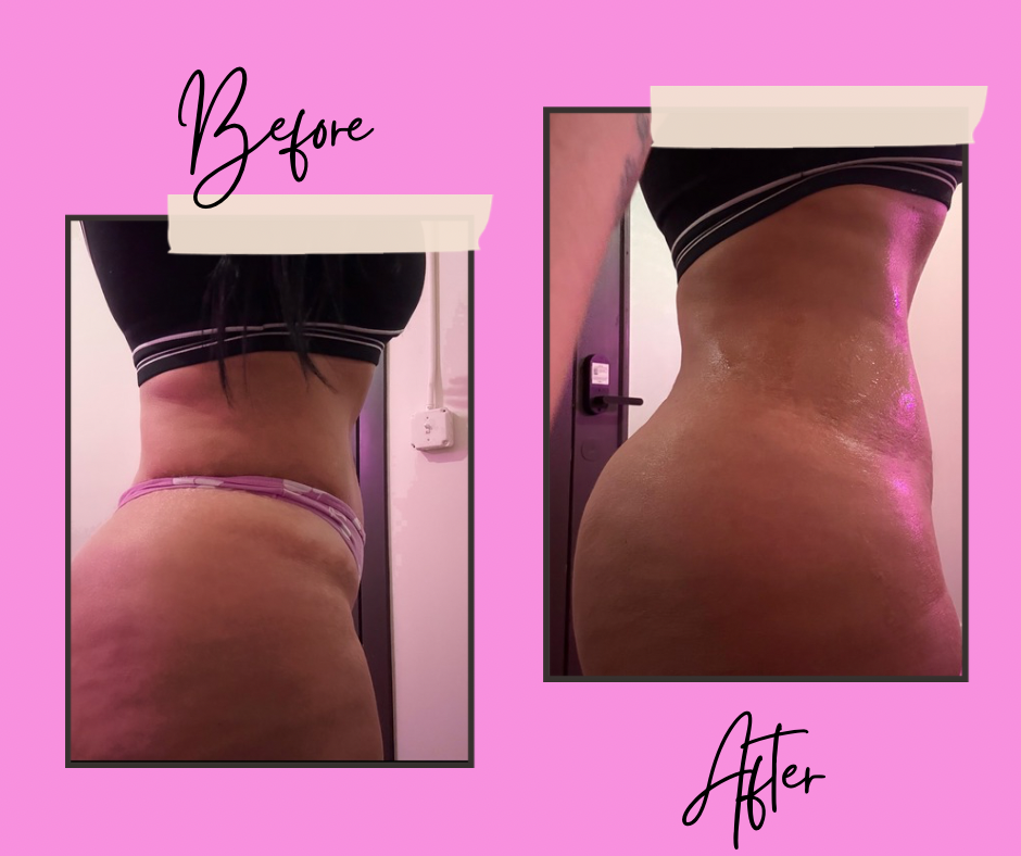Body Contouring Class