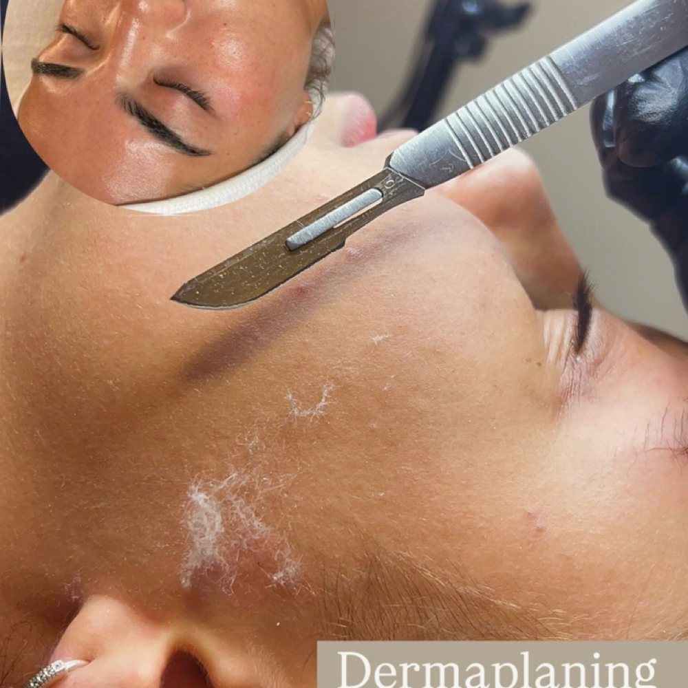 Dermaplanning facial at Skindia Aesthetics in Deer Park, TX