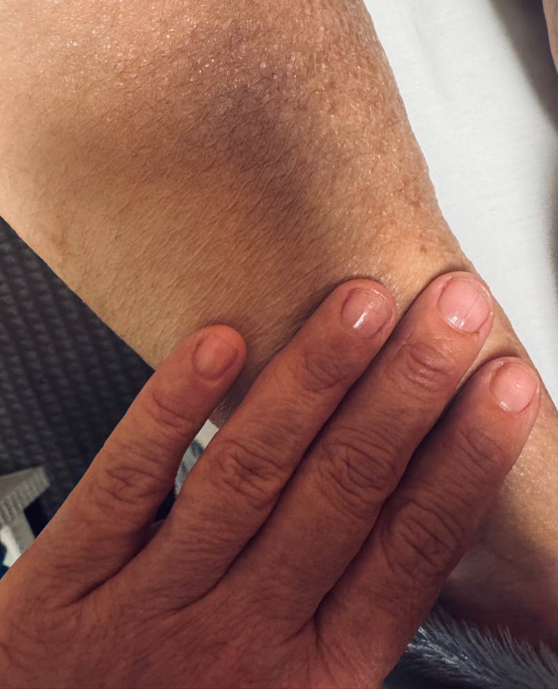 Oncology Massage