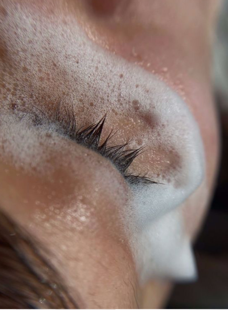 Lash Removal