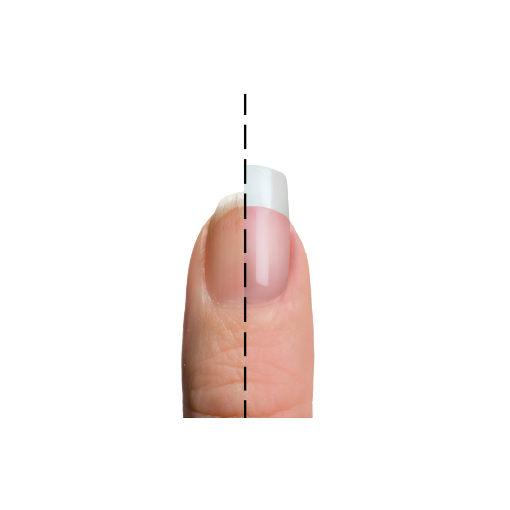 Nail Repair