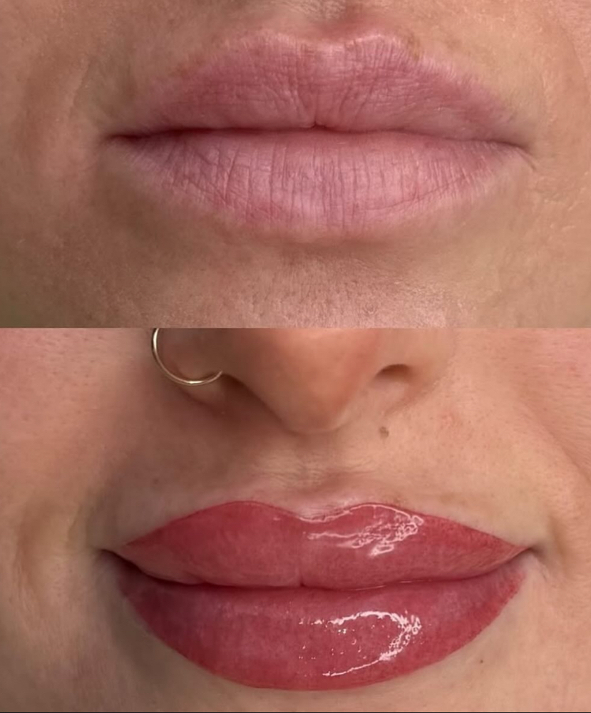 Lip Blushing at DVASH AESTHETICS in Harlingen, TX