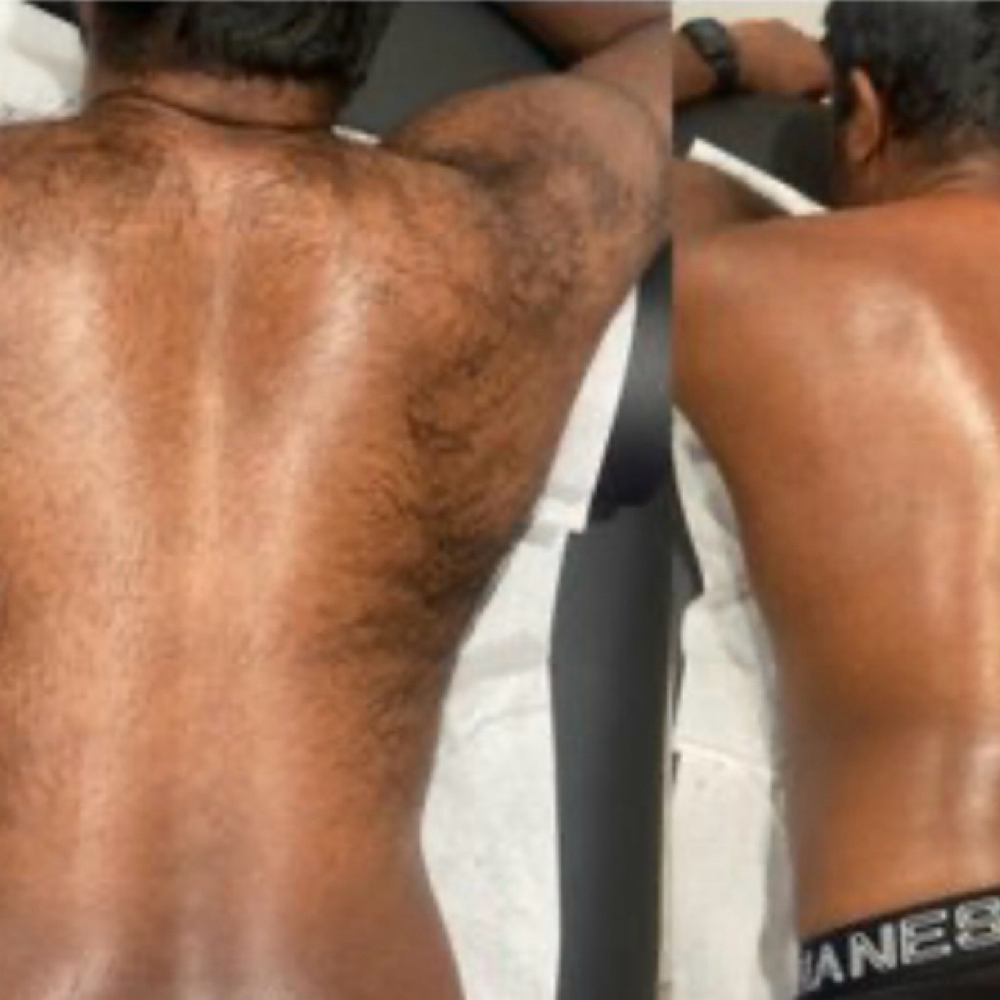 Chest & Back Wax Combo Men at WYN SKIN & BROWS in Dallas, TX
