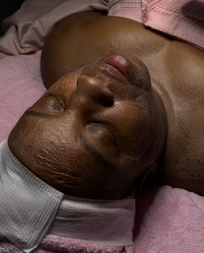 Enzyme Facial Treatment