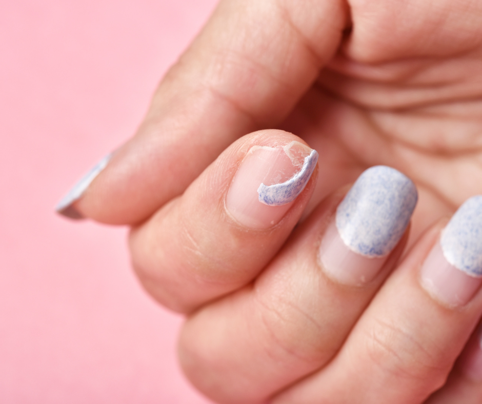 Nail Repair