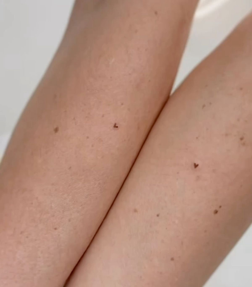 Febuary Special - Heart Freckle at Boston Beauty Ink in Canton, MA