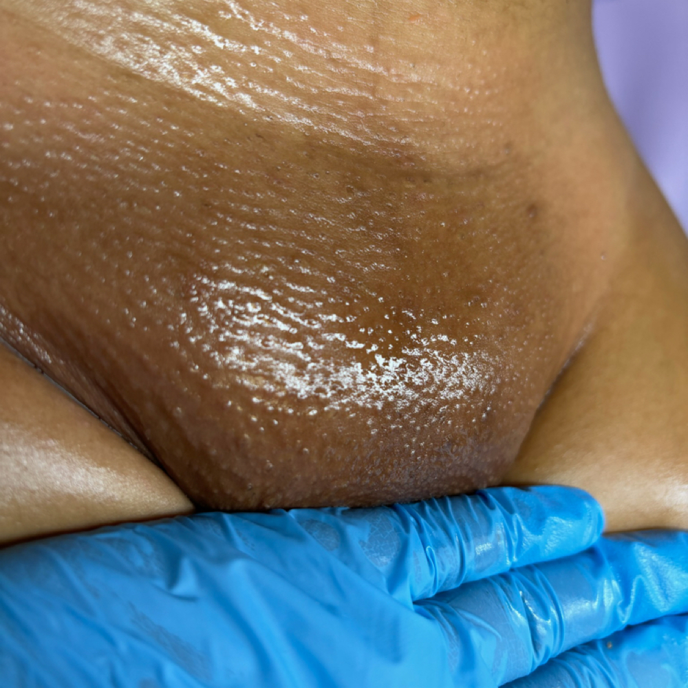 Brazilian - Student Wednesday Only at ALL GLOWN UP SKINCARE in Temple Hills, MD