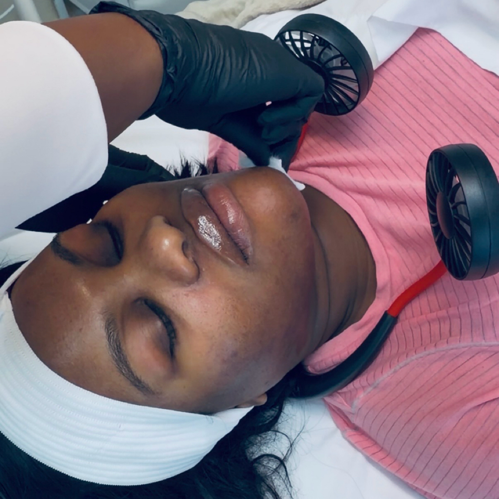 Chemical Treatment at Skin by Amile in Oxon Hill, MD