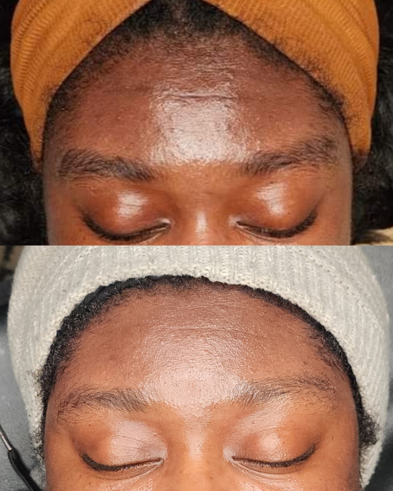 Skin Revision Introduction