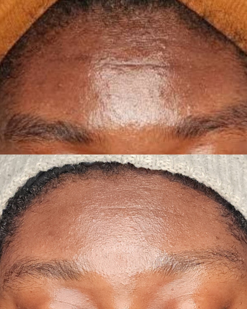 Skin Revision Introduction