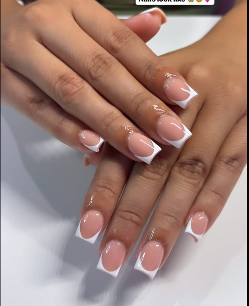 Acrylic Overlay