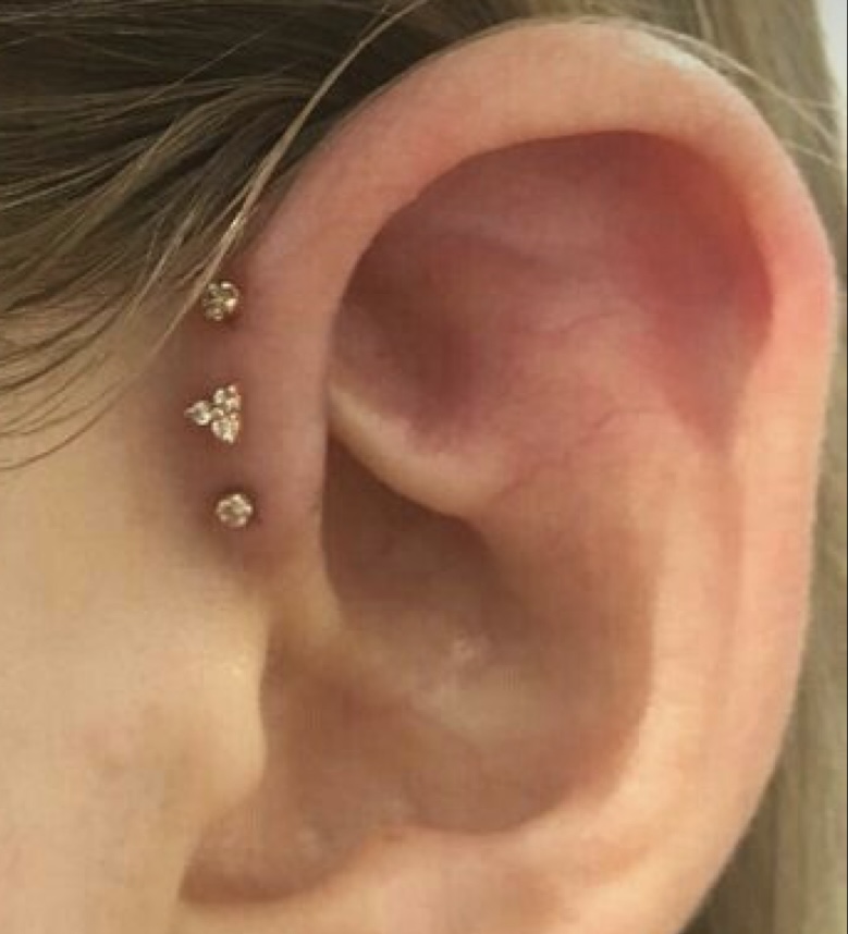 Forward Helix Piercing