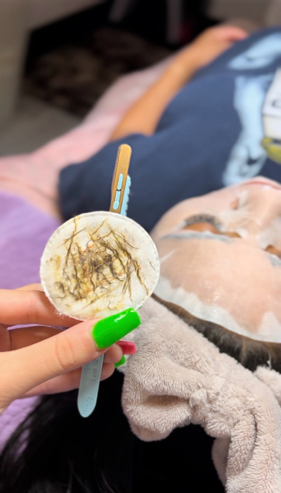 Dermaplane