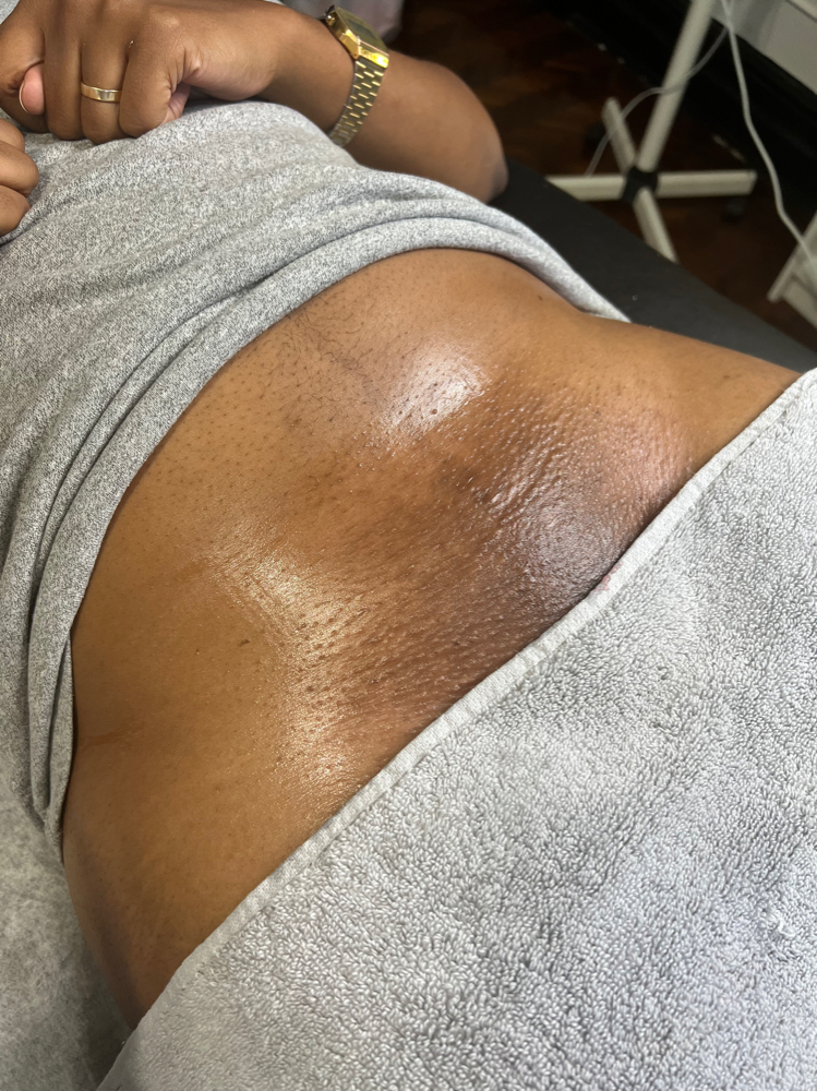 Brazilian Wax