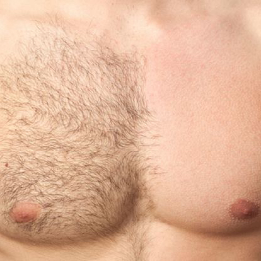 Chest Wax