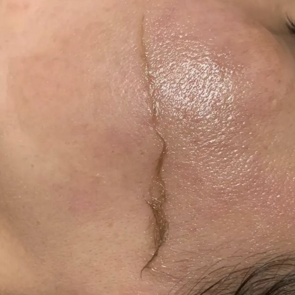Dermaplane Add On at Amber The Skin Fairy in Sevierville, TN