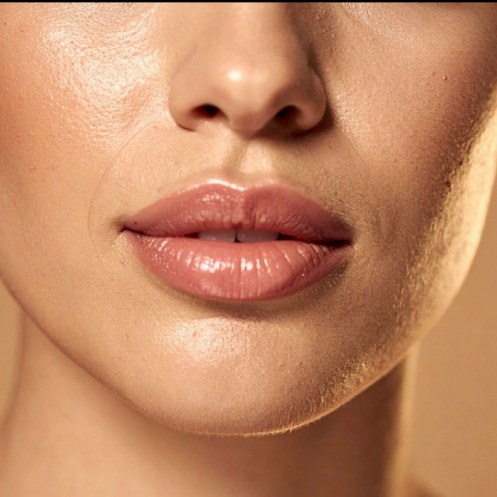 Upper Lip Laser- One Session Only at SLS Laser Medspa in Ontario, CA