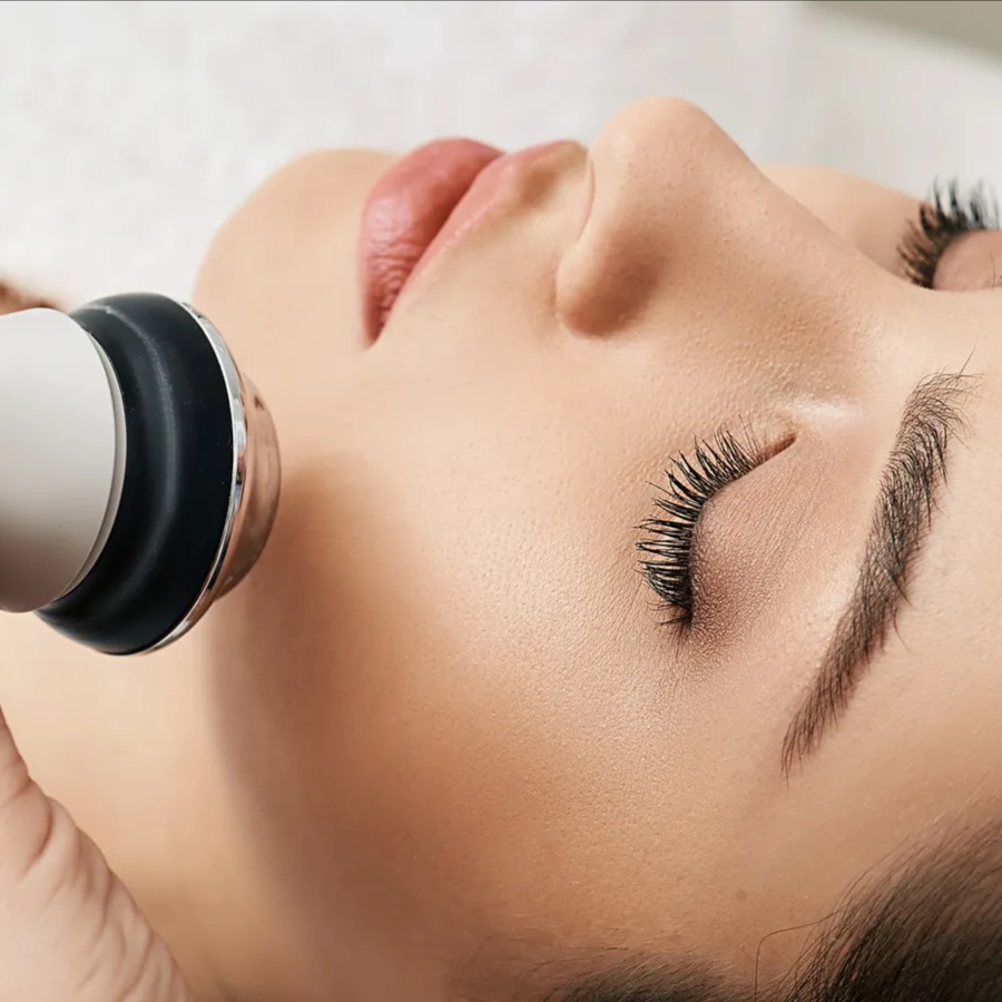 RF Facial (Radio Frequency) at Rejuven Esthetic in vienna, VA