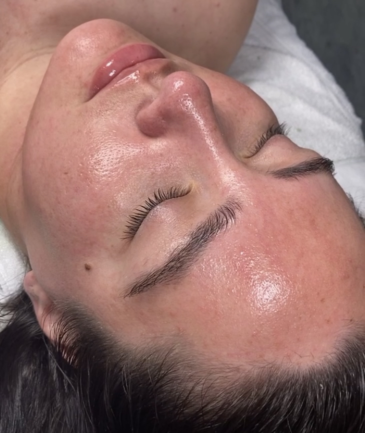 Luminizing Skin Treatment