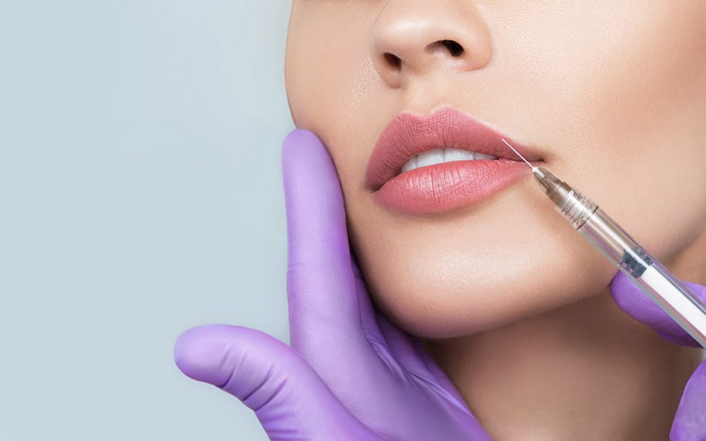 Lip Filler-Full Syringe