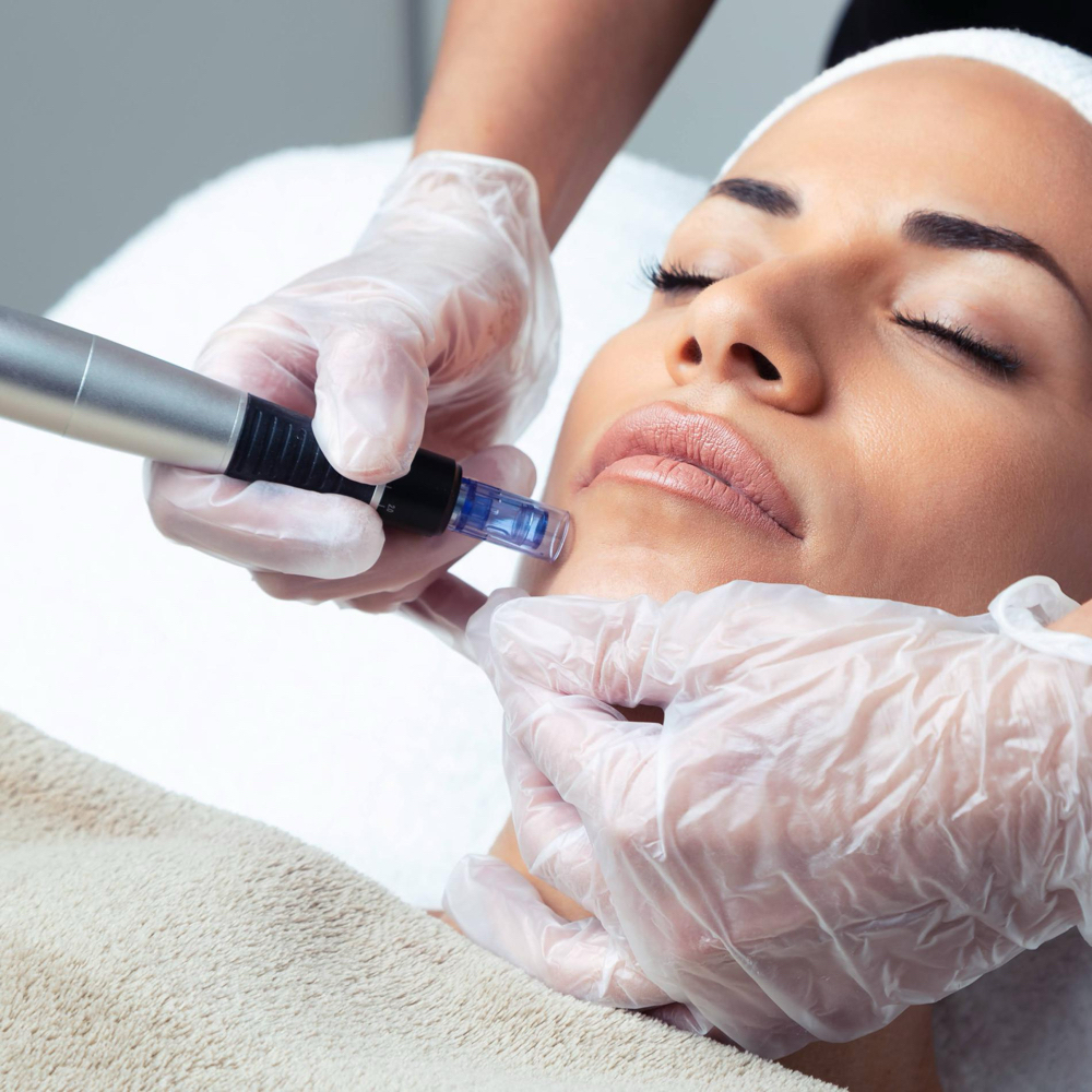New Client Intro Offer at Estetica in Venice, FL