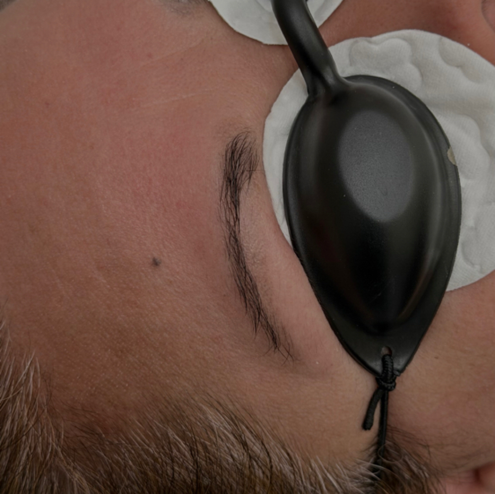 Eyebrow Tattoo Removal at Velvet Pro Beauty in Brentwood, CA