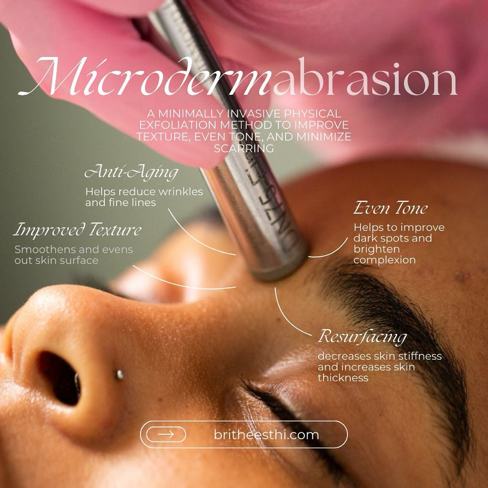 Microdermabrasion