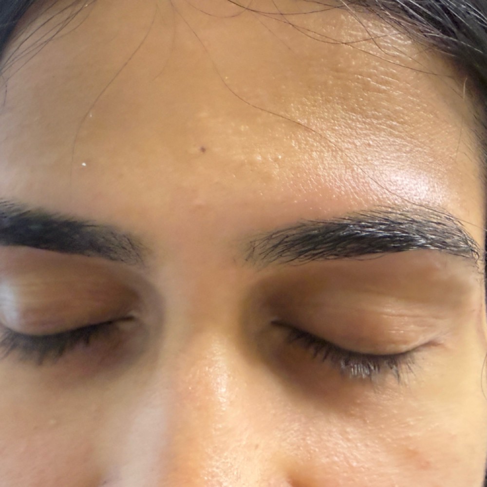 Forehead Threading at Beautiess Esthetic in Concord, NC