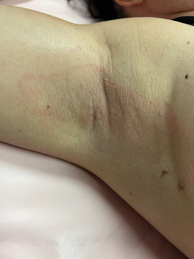 Underarm Wax